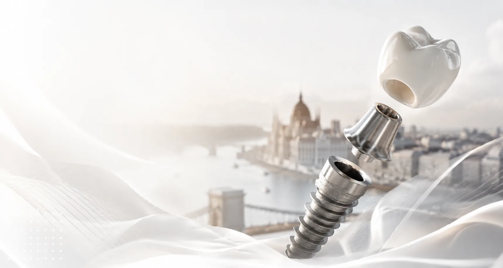 Dental implant