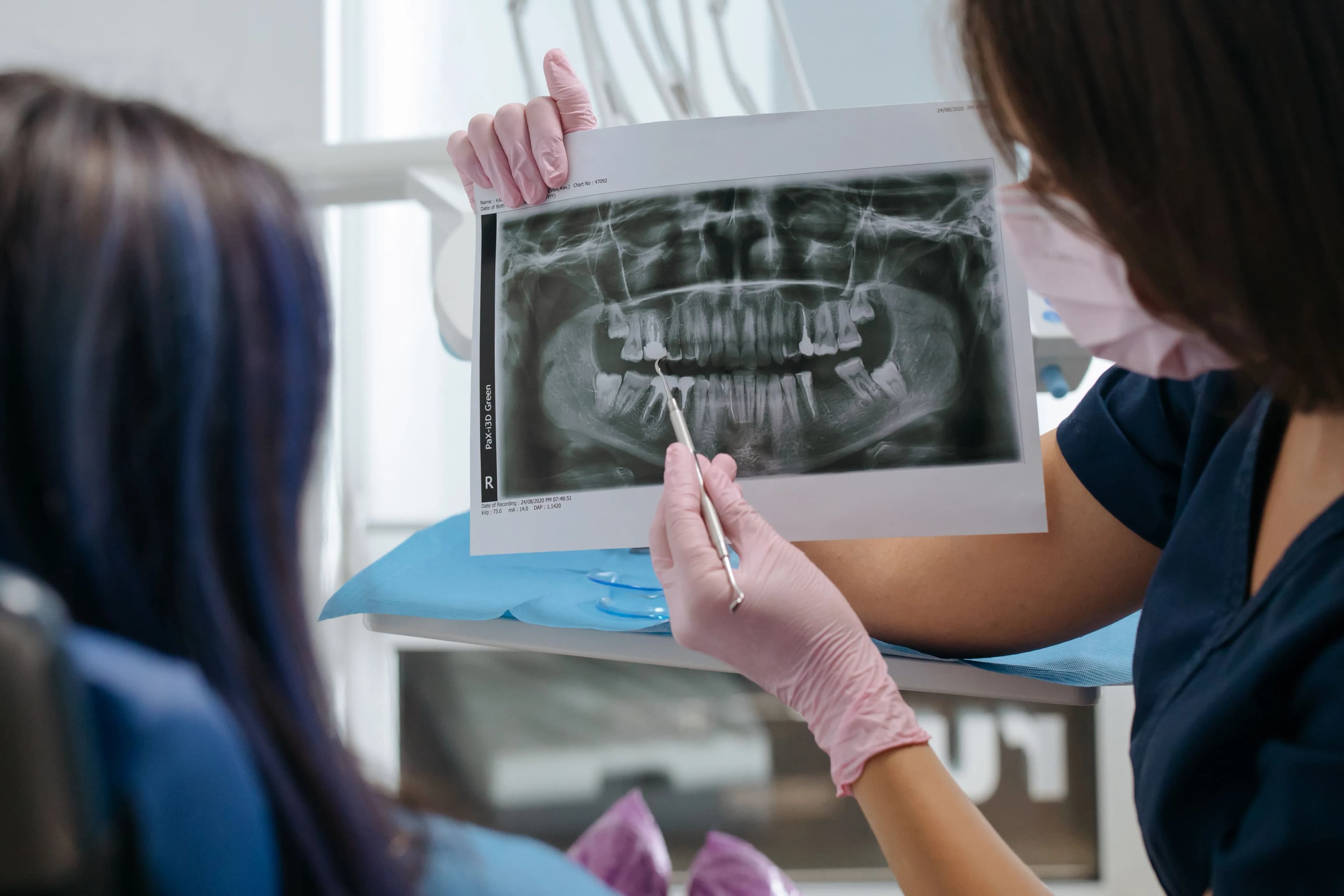 Dental treatment planning conversation using a panoramic X-ray record