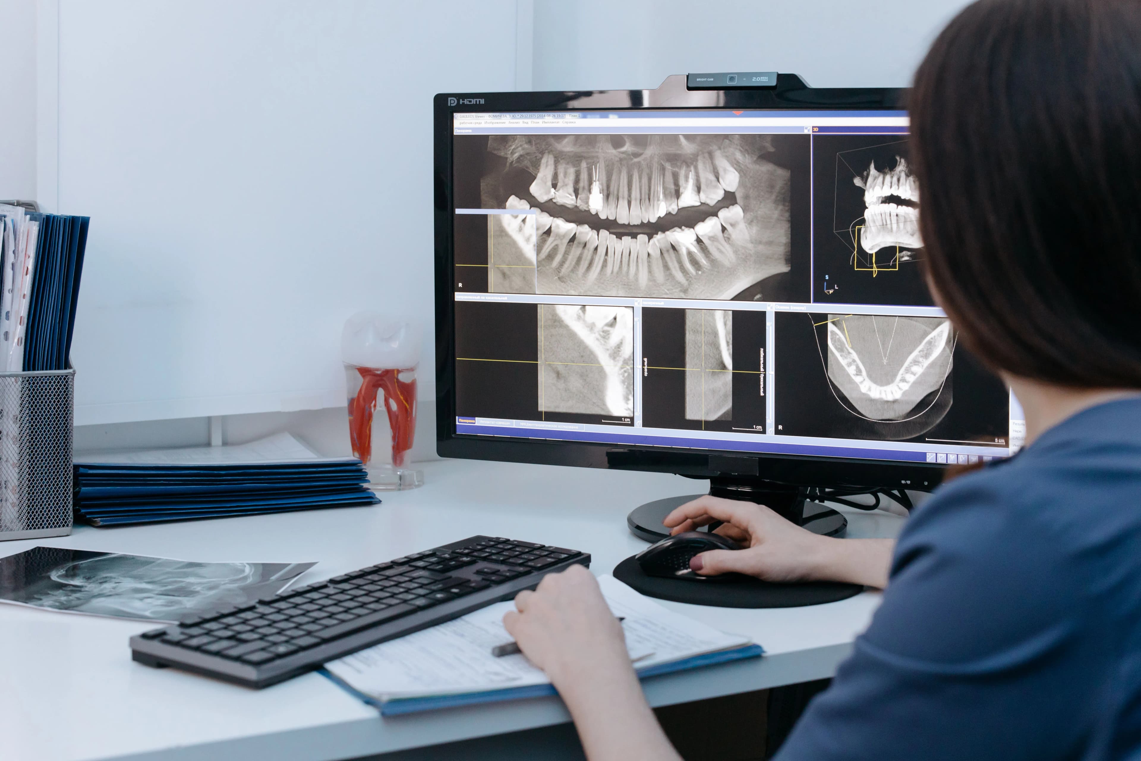 What Records Should You Receive After Dental Implants Abroad? article cover image